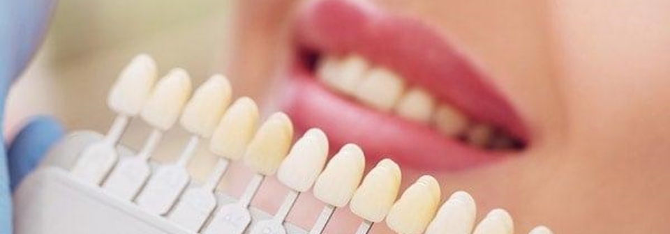 sonicare prestige 9900