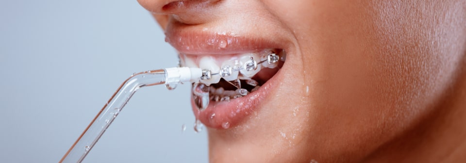 sonicare prestige 9900