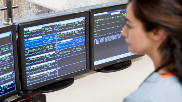 Alarm management 101