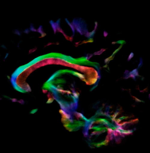 UVM research fiber tracking
