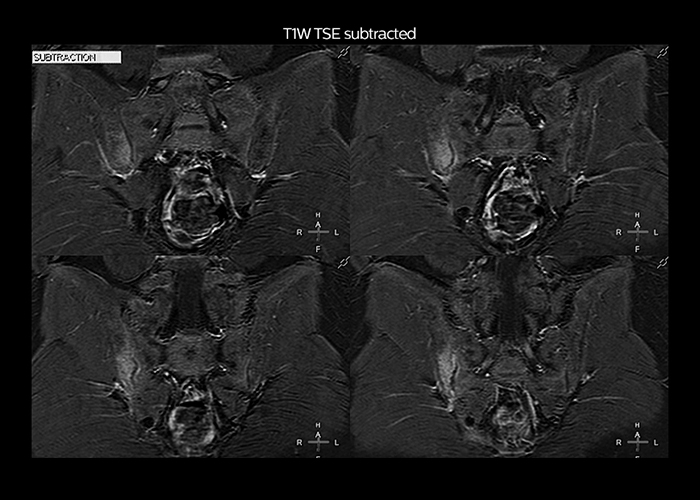 clinical cases tab2 image