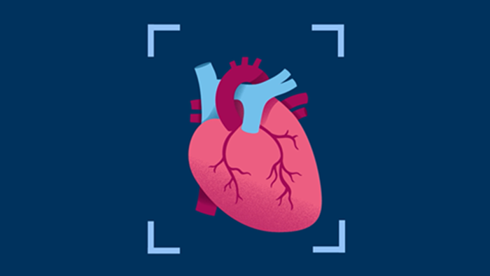 Cardiac CT 5300 video