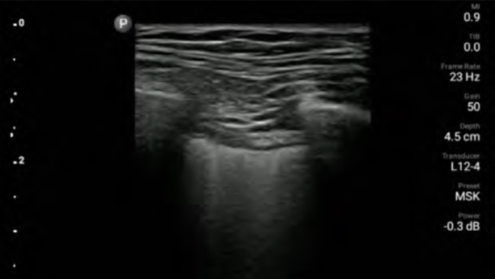 Un medic lucr&acirc;nd la tabletă