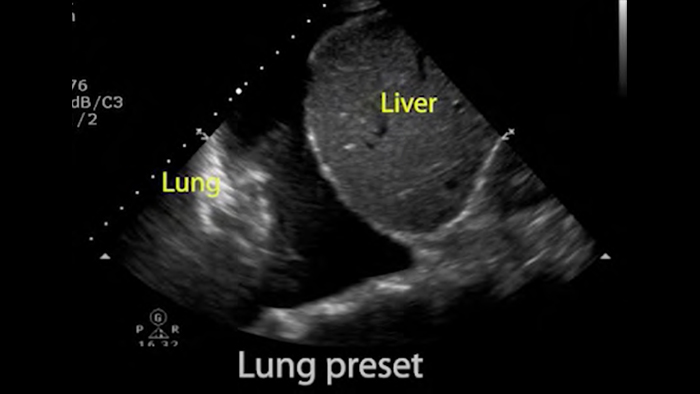 Pacient primind tratament