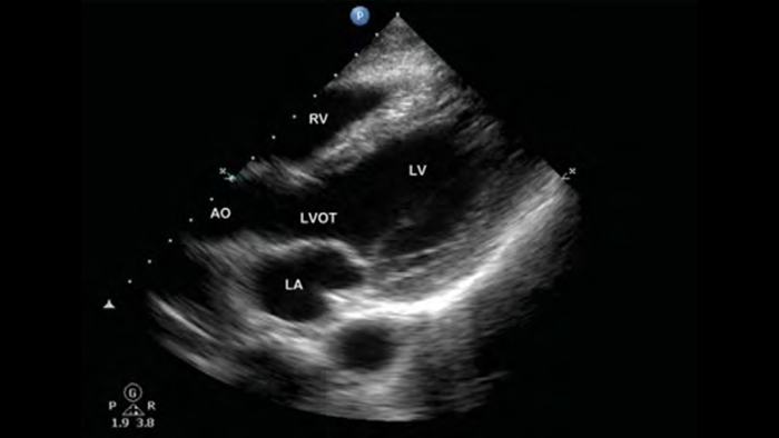 Telefon alături de un produs Lumify