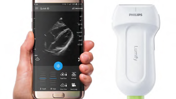 Telefon alături de un produs Lumify