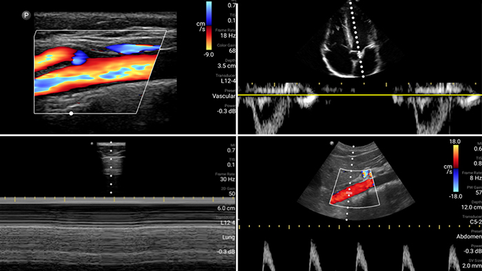 Prima imagine de caz