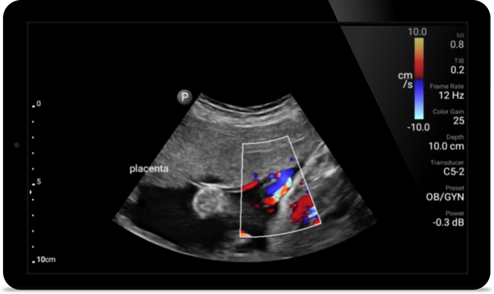 Imagine de caz Padstatic