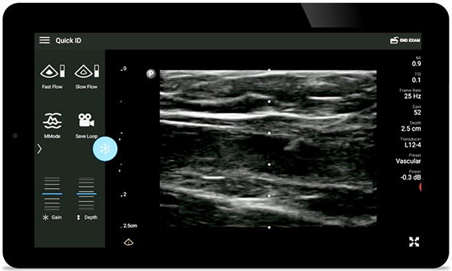 Reduceţi complicaţiile