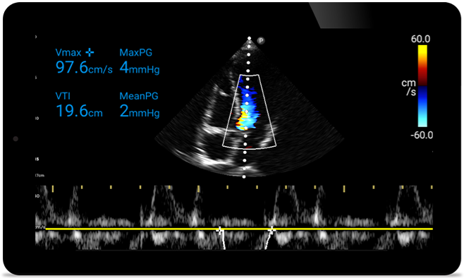 Acţionaţi mai rapid pentru a le proteja inima