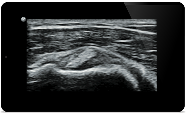 &Icirc;ncepeţi tratamentul cu un diagnostic precis