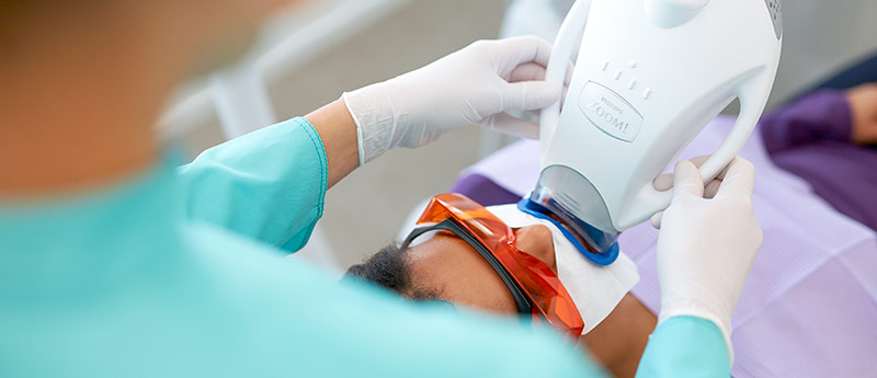 Pentru a obţine cel mai luminos z&acirc;mbet posibil