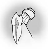 Měkk&aacute; vl&aacute;kna