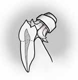 Měkk&aacute; vl&aacute;kna