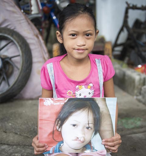 Jhoanna &icirc;nainte şi după operaţie