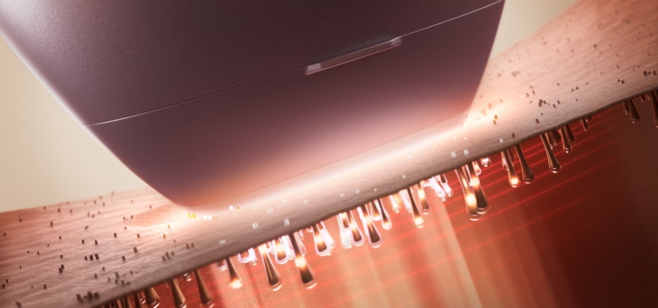 Additional functions of the epilator