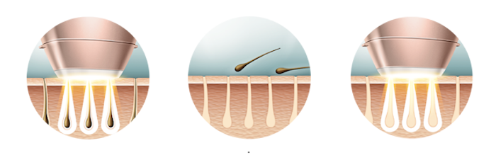 Cresterea parului prevenita